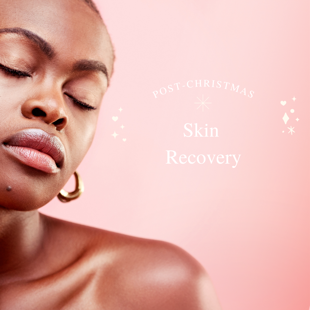 How to help your skin recover Post-Christmas.